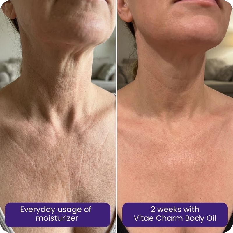 Body Oil for GLP-1 Users